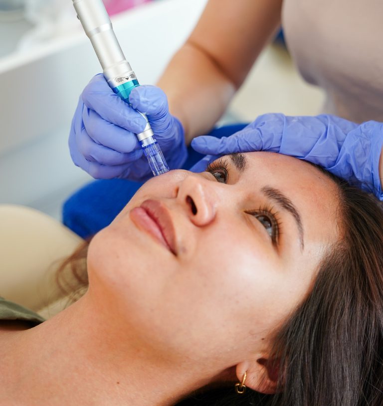 Beautician treating a client’s cheek with a microneedling pen at AFACIAL in Vienna