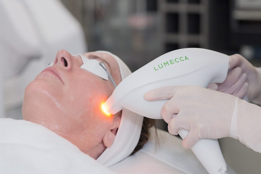 Pigmentation spot treatment with the laser handpiece on a client's cheek, eyes protected, in Vienna