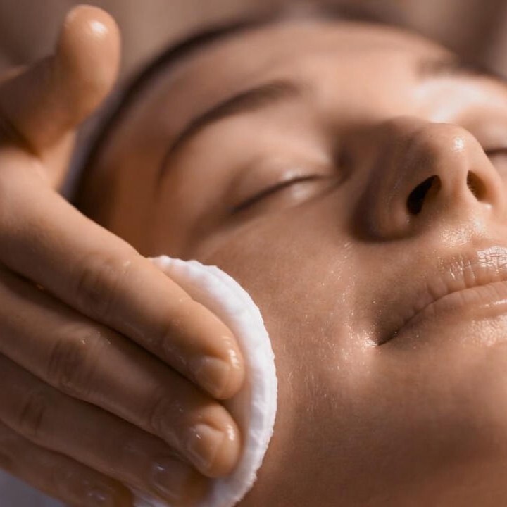 Skin cleansed with cotton pads before treatment - preparing for microneedling in Vienna
